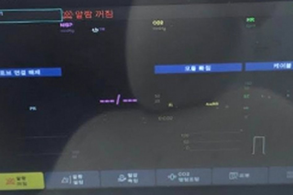 환자감시장치