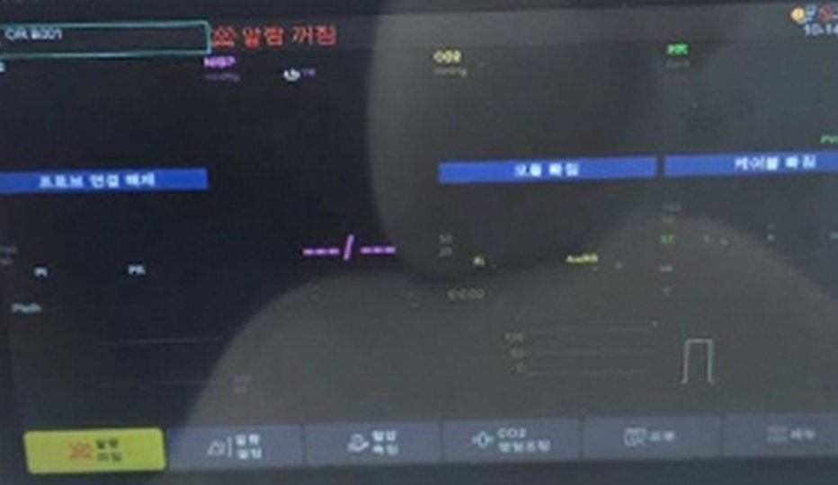 환자감시장치